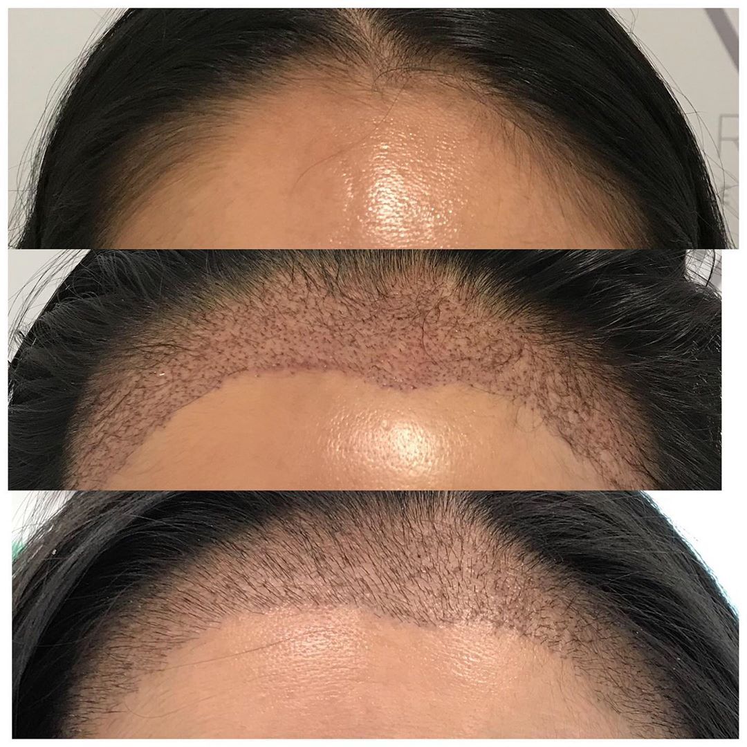 Hairline Tint - Precise Front Coverage & Definition