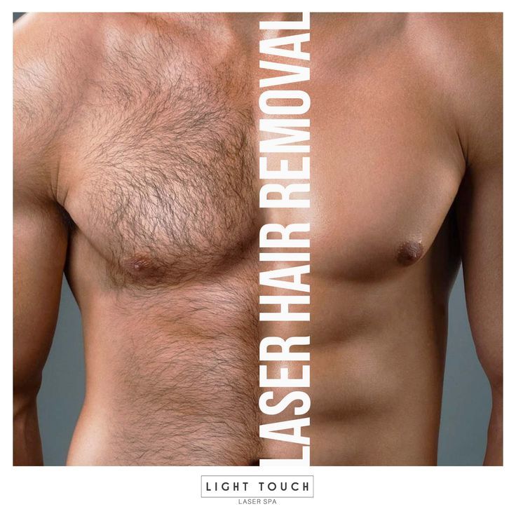 Laser Hair Removal for Men - Professional Male Hair Reduction